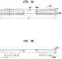 Fig. 06 - Convertibility of a bone conduction device