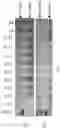 Fig. 09 - Method of using a genetically modified mouse that expresses a humanized CTLA-4 gene