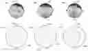 Fig. 01 - System and method for automatic torsion correction in diagnostic ophthalmic measurements
