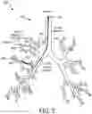 Fig. 06 - Medical navigation system using shape-sensing device and method of operation thereof