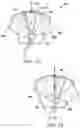 Fig. 09 - Blood sequestration device and method