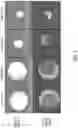 Fig. 07 - System and method for quantifying luminal stenosis using multi-energy computed tomography imaging