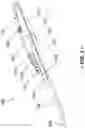 Fig. 02 - Handheld Ultrasound Device and Replaceable Tips Therefor