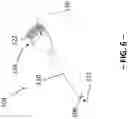 Fig. 08 - Handheld Ultrasound Device and Replaceable Tips Therefor