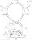 Fig. 01 - SUTURE CLIP AND APPLIER TOOL