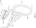 Fig. 06 - SUTURE CLIP AND APPLIER TOOL