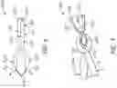 Fig. 07 - SUTURE CLIP AND APPLIER TOOL