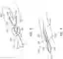 Fig. 08 - SUTURE CLIP AND APPLIER TOOL