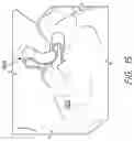 Fig. 14 - SUTURE CLIP AND APPLIER TOOL