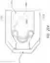 Fig. 19 - SUTURE CLIP AND APPLIER TOOL