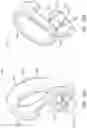Fig. 30 - SUTURE CLIP AND APPLIER TOOL