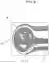 Fig. 17 - Aneurysm device and delivery system
