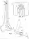 Fig. 02 - Orthopedic reamer with expandable cutting head