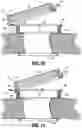 Fig. 07 - Attachments for use with a surgical access device