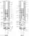 Fig. 07 - Spinal correction system and method