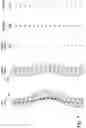 Fig. 06 - Adjusting spinal curvature