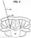 Fig. 07 - Methods and devices for spinal fixation element placement