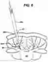 Fig. 08 - Methods and devices for spinal fixation element placement