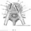 Fig. 04 - Spinal screw with movable tip