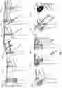 Fig. 02 - BONE FRACTURE REPAIR APPARATUS AND METHODS