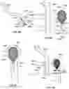 Fig. 45 - BONE FRACTURE REPAIR APPARATUS AND METHODS