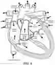 Fig. 07 - Real-time lesion formation assessment