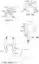 Fig. 09 - Minimally invasive surgical system