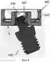 Fig. 09 - IMPLANT ATTACHMENT SYSTEM