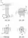 Fig. 07 - Overdrive prevention for expandable anchor