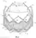 Fig. 03 - Covered prosthetic heart valve