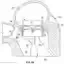 Fig. 04 - Covered prosthetic heart valve