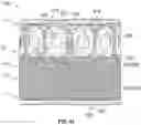 Fig. 32 - Covered prosthetic heart valve