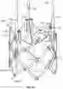 Fig. 40 - Covered prosthetic heart valve