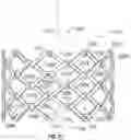 Fig. 41 - Covered prosthetic heart valve