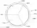 Fig. 01 - Prosthetic heart valves with elastic support structures and related methods