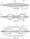Fig. 11 - Delivery systems for prosthetic heart valve