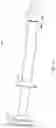 Fig. 12 - Cardiac valve delivery devices and systems