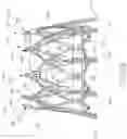 Fig. 47 - Implantable device and delivery system for reshaping a heart valve annulus