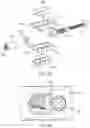 Fig. 41 - Expandable implant assembly