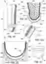 Fig. 06 - Prosthetic interface