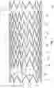 Fig. 02 - Highly flexible stent and method of manufacture