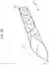Fig. 33 - Highly flexible stent
