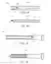 Fig. 02 - METHODS FOR TOPOSCOPIC SLEEVE DELIVERY