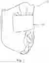 Fig. 02 - REVERSIBLE AND CONFIGURABLE ABSORBENT ARTICLES