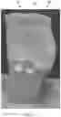 Fig. 06 - Absorbent article having elastic belt