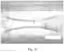Fig. 63 - Absorbent Articles Having Zones