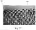 Fig. 77 - Absorbent Articles Having Zones