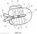 Fig. 07 - Angle adjustable crutch handle