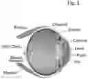 Fig. 02 - EYE-INJECTABLE POLYMERIC NANOPARTICLES AND METHOD OF USE THEREFOR