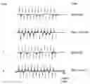 Fig. 01 - ARTICLES FOR TREATING CONCUSSION AND OTHER DISORDERS